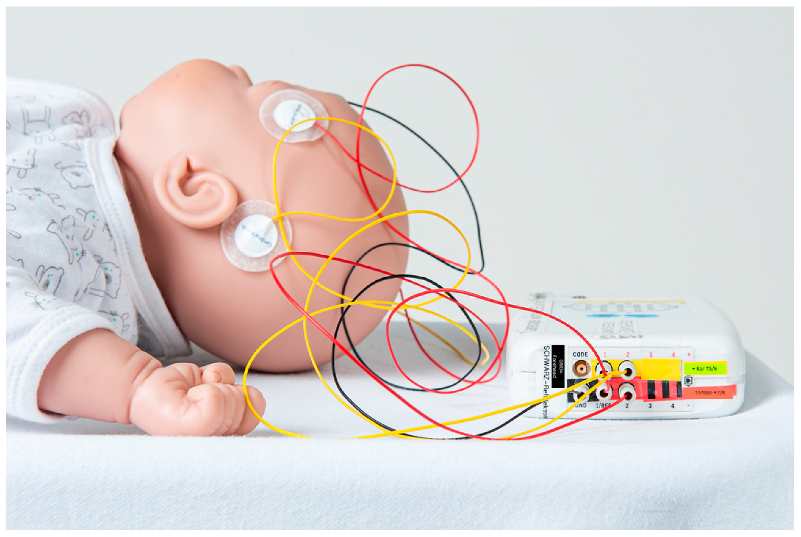 BRUE for the Final FRCEM SBA Exam